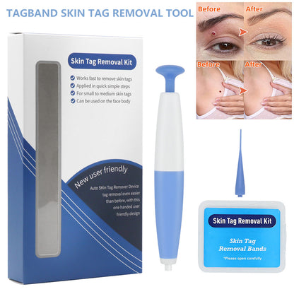 BenZvibe Skin Tag & Mole Removal Kit – Home Use Wart Remover & Skin Care Tool